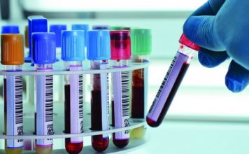 საქართველოში გამოკვლეულ ბავშვთა 25 პროცენტის სისხლში ტყვიის შემცველობამ მოიმატა